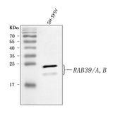 Anti-RAB39A/B Antibody Picoband® Boster Bio