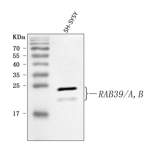 Anti-RAB39A/B Antibody Picoband® Boster Bio