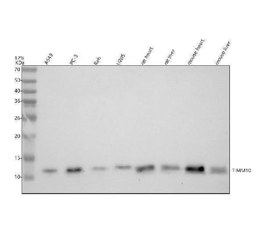 Anti-TIM10/TIMM10 Antibody Picoband® Boster Bio