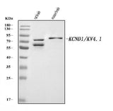 Anti-KCND1 Antibody Picoband® Boster Bio