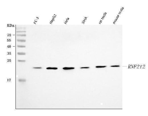 Anti-RNF212 Antibody Picoband® Boster Bio