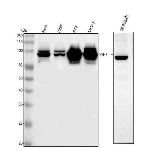 Anti-SSH3 Antibody Picoband® Boster Bio
