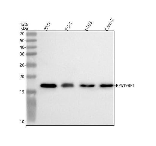 Anti-RPS19BP1 Antibody Picoband® Boster Bio