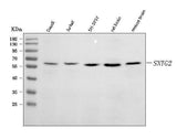 Anti-SNTG2 Antibody Picoband® Boster Bio