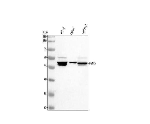 Anti-PGM5 Antibody Picoband® Boster Bio