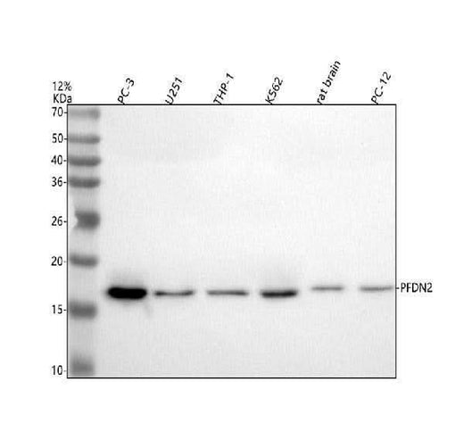 Anti-PFDN2 Antibody Picoband® Boster Bio