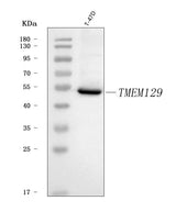 Anti-TMEM129 Antibody Picoband® Boster Bio