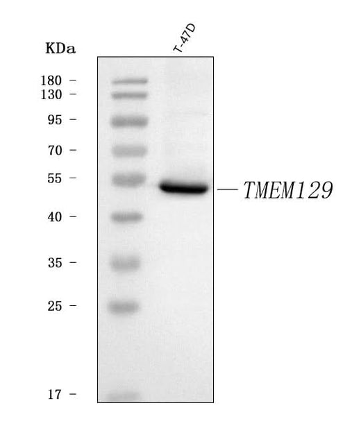 Anti-TMEM129 Antibody Picoband® Boster Bio