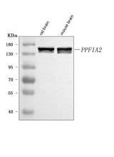 Anti-PPFIA2 Antibody Picoband® Boster Bio