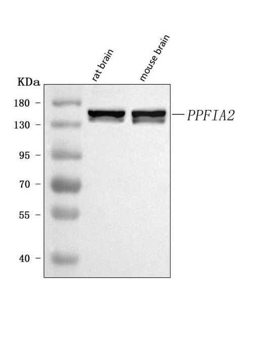 Anti-PPFIA2 Antibody Picoband® Boster Bio