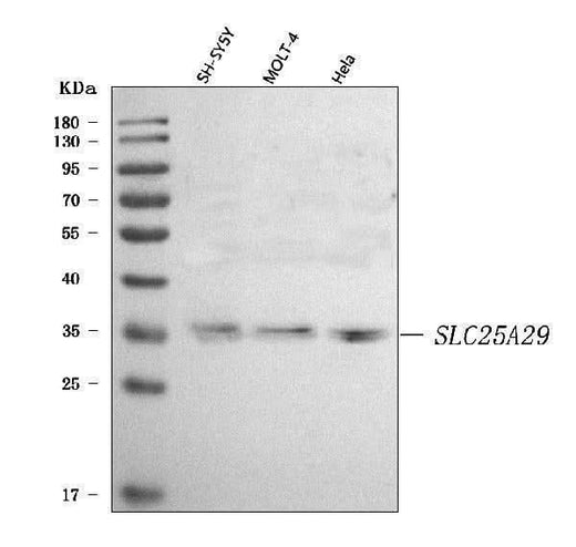 Anti-SLC25A29 Antibody Picoband® Boster Bio