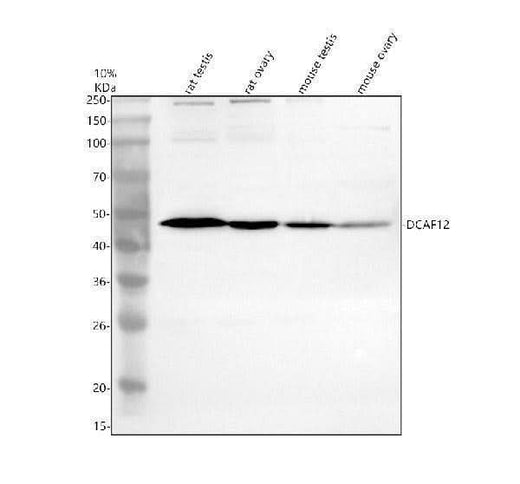 Anti-DCAF12 Antibody Picoband® Boster Bio