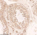 Anti-DAND5 Antibody Boster Bio