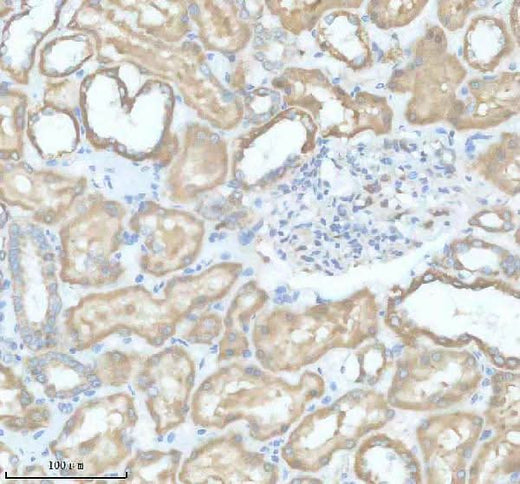 Anti-SLC9A7 Antibody Boster Bio