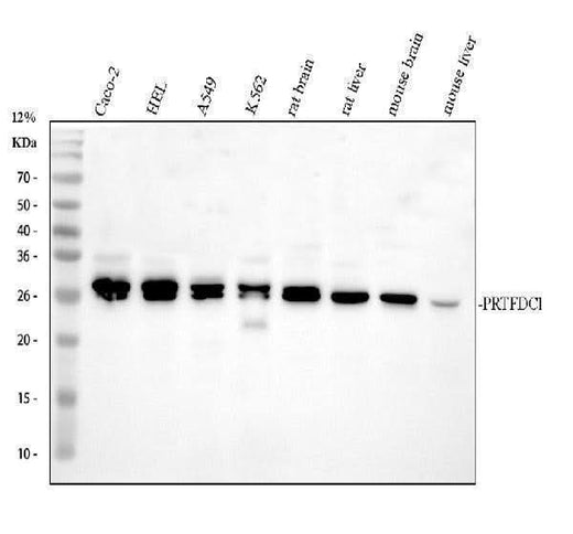 Anti-PRTFDC1 Antibody Picoband® Boster Bio