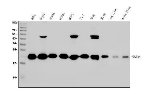 Anti-NDUFB10 Antibody Picoband® Boster Bio