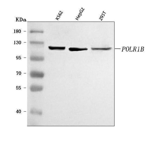 Anti-POLR1B Antibody Picoband® Boster Bio