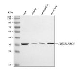 Anti-ST6GALNAC4 Antibody Picoband® Boster Bio
