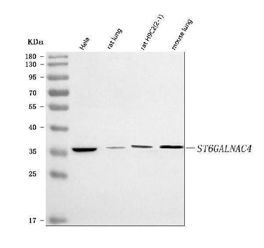 Anti-ST6GALNAC4 Antibody Picoband® Boster Bio