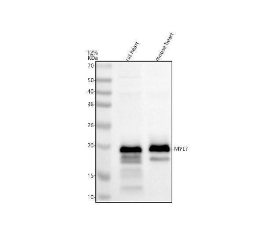 Anti-MYL7 Antibody Picoband® Boster Bio