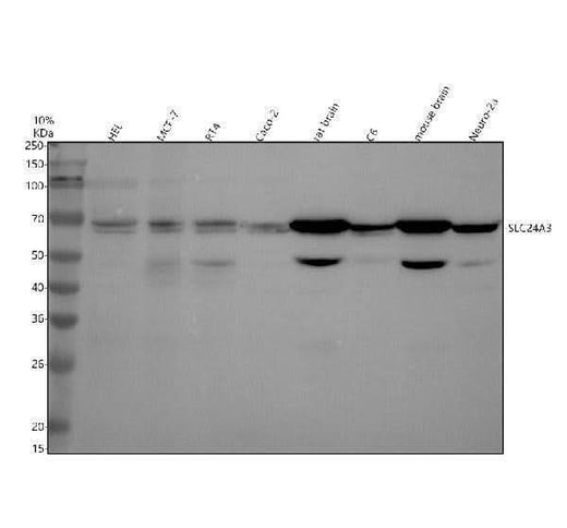 Anti-SLC24A3 Antibody Picoband® Boster Bio