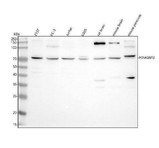 Anti-POMGNT2 Antibody Picoband® Boster Bio