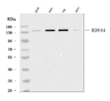 Anti-WDR44 Antibody Picoband® Boster Bio