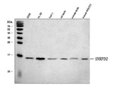 Anti-SNRPD2 Antibody Picoband® Boster Bio
