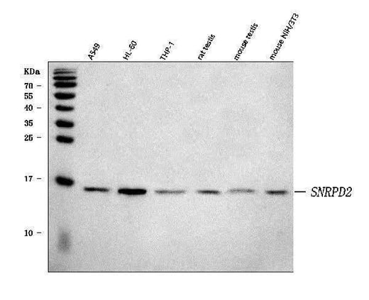 Anti-SNRPD2 Antibody Picoband® Boster Bio
