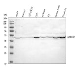Anti-ST8SIA3 Antibody Picoband® Boster Bio