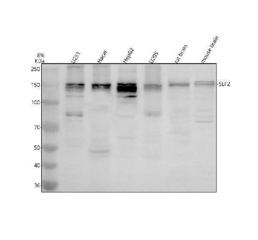 Anti-SLF2 Antibody Picoband® Boster Bio