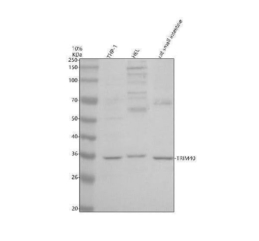 Anti-TRIM40 Antibody Picoband® Boster Bio