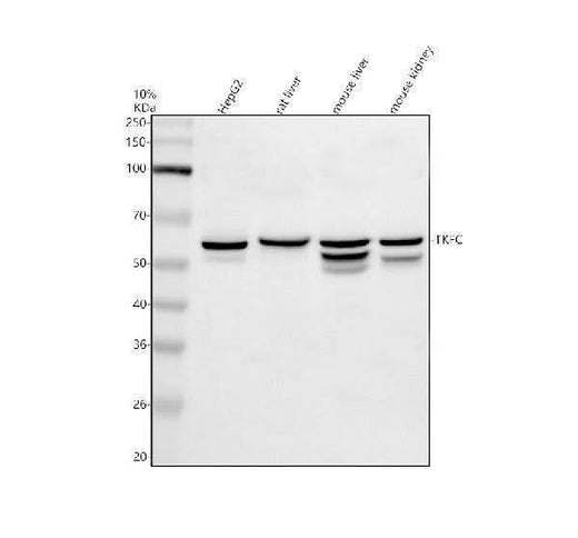 Anti-DAK/TKFC Antibody Picoband® Boster Bio