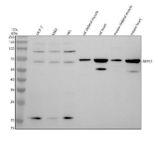 Anti-SRPK3 Antibody Picoband® Boster Bio