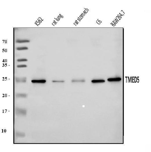 Anti-TMED5/p28 Antibody Picoband® Boster Bio