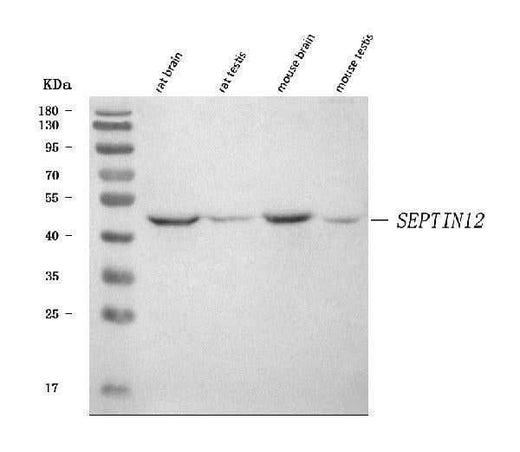 Anti-SEPTIN12 Antibody Picoband® Boster Bio