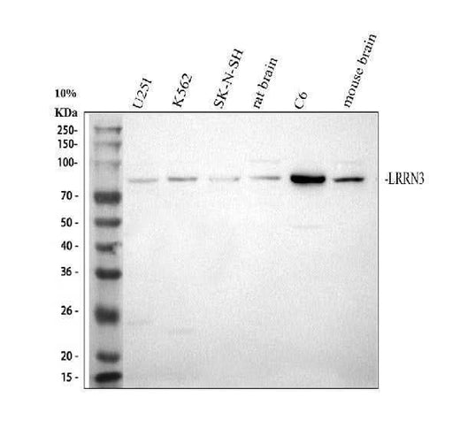 Anti-LRRN3 Antibody Picoband® Boster Bio