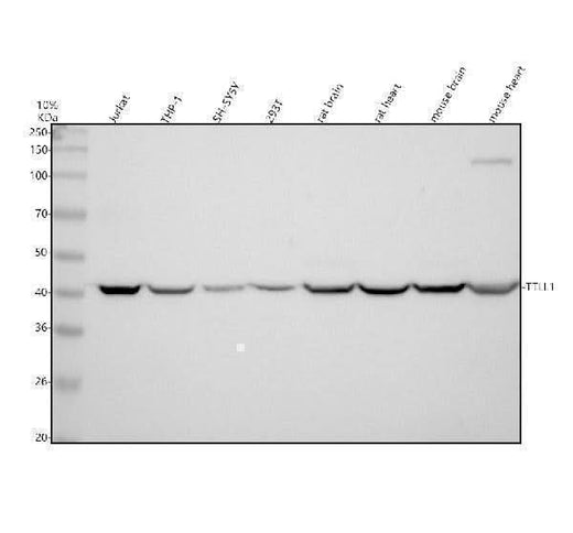 Anti-TTLL1 Antibody Picoband® Boster Bio