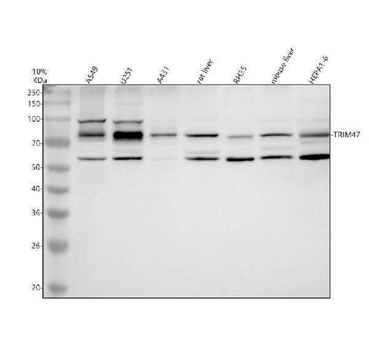 Anti-TRIM47 Antibody Picoband® Boster Bio