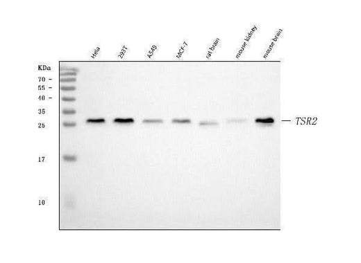 Anti-TSR2 Antibody Picoband® Boster Bio