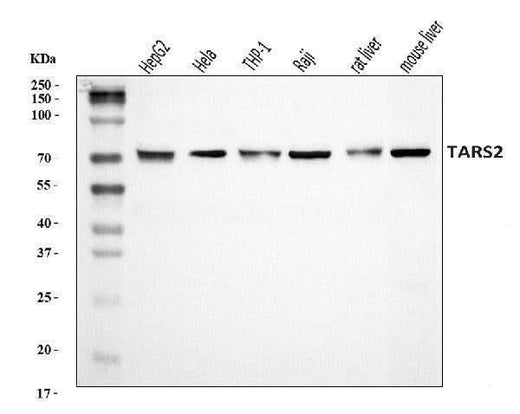 Anti-TARS2 Antibody Picoband® Boster Bio