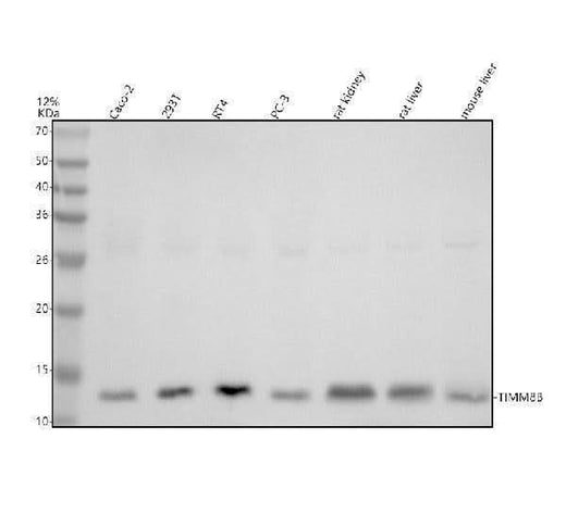 Anti-TIMM8B Antibody Picoband® Boster Bio
