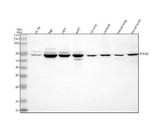 Anti-RTKN2 Antibody Picoband® Boster Bio
