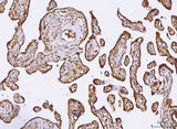 Anti-PKIB Antibody Boster Bio