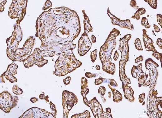 Anti-PKIB Antibody Boster Bio
