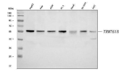 Anti-TRMT61B Antibody Picoband® Boster Bio