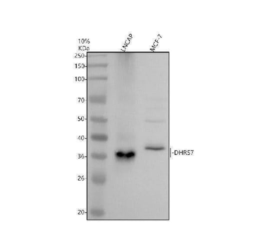 Anti-DHRS7 Antibody Picoband® Boster Bio