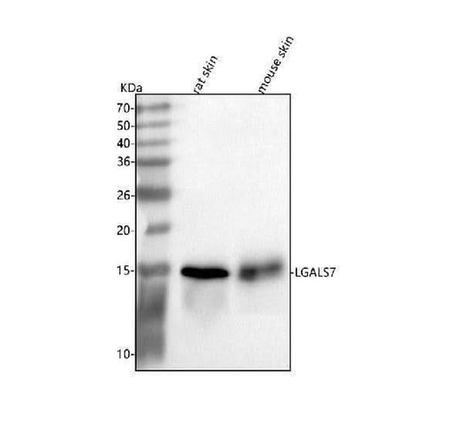 Anti-Galectin-7/LGALS7 Antibody Picoband® Boster Bio