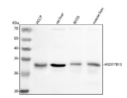 Anti-HSD17B13 Antibody Picoband® Boster Bio