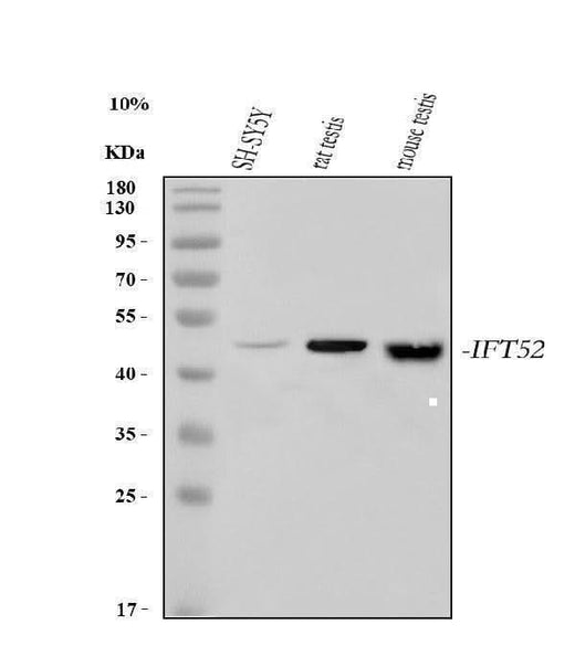 Anti-IFT52 Antibody Picoband® Boster Bio